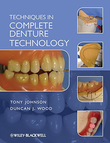 Techniques In Complete Denture Technology 1st Edition Duncan J Wood