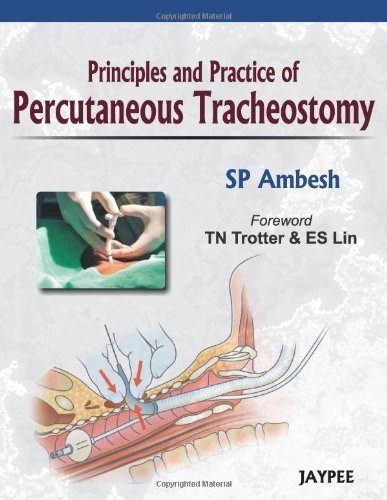 Principles And Practice Of Percutaneous Tracheostomy 1st Edition S P Ambesh