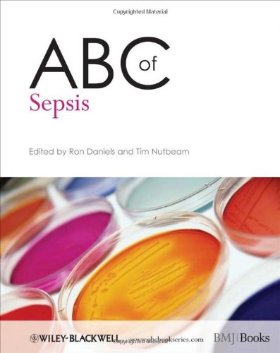Abc Of Sepsis 1st Edition Ron Daniels Tim Nutbeam