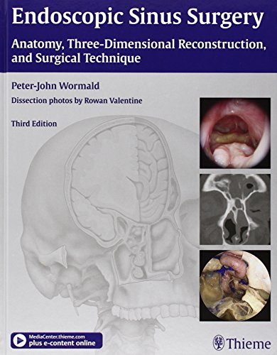 Endoscopic Sinus Surgery Anatomy Threedimensional Reconstruction And Surgical Technique 3rd Edition Peterjohn Wormald