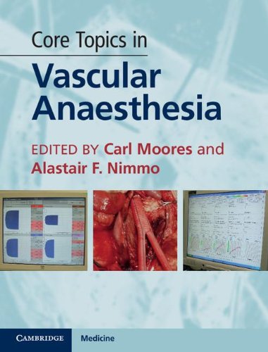 Core Topics In Vascular Anaesthesia 1st Edition Carl Moores Alastair F Nimmo
