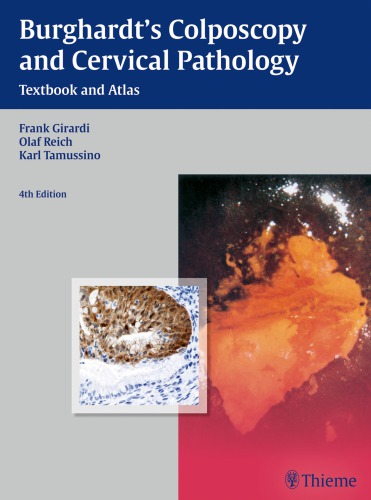 Burghardts Colposcopy And Cervical Pathology Textbook And Atlas 4th Edition Frank Girardi
