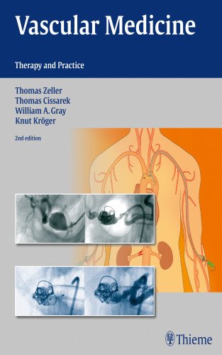Vascular Medicine Therapy And Practice 2nd Edition Thomas Zeller Et Al