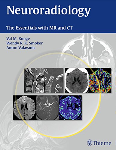 Neuroradiology The Essentials With Mr And Ct 1st Edition V M Runge