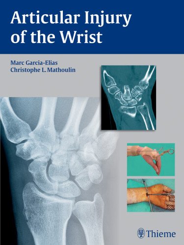 Articular Injury Of The Wrist Fessh 2014 Instructional Course Book 1st Edition Marc Garciaelias