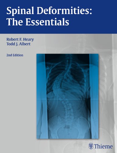 Spinal Deformities The Essentials 2nd Edition Robert F Heary