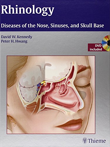 Rhinology Diseases Of The Nose Sinuses And Skull Base 1st Edition David W Kennedy
