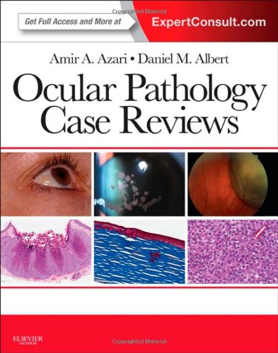 Ocular Pathology Case Reviews Amir A Azari Daniel M Albert