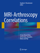 Mriarthroscopy Correlations A Casebased Atlas Of The Knee Shoulder Elbow And Hip 1st Edition Stephen F Brockmeier Eds