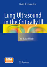 Lung Ultrasound In The Critically Ill The Blue Protocol 1st Edition Daniel A Lichtenstein Auth