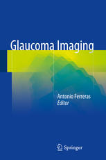 Glaucoma Imaging 1st Edition Antonio Ferreras Eds