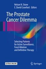 The Prostate Cancer Dilemma Selecting Patients For Active Surveillance Focal Ablation And Definitive Therapy 1st Edition Stone Nelson N Ed Crawford E David Ed
