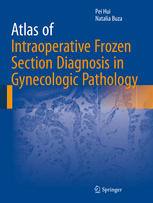 Atlas Of Intraoperative Frozen Section Diagnosis In Gynecologic Pathology 1st Edition Pei Hui