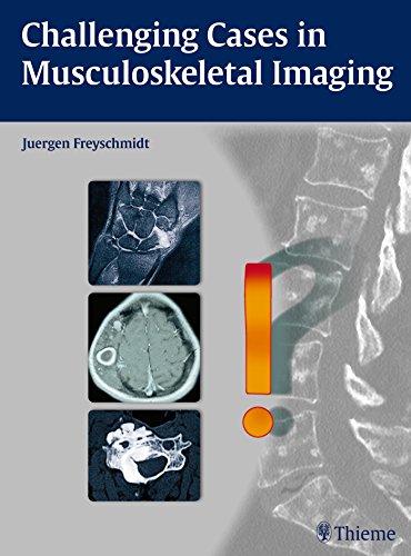 Challenging Cases In Musculoskeletal Imaging 1st Edition Jrgen Freyschmidt