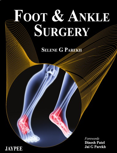 Foot And Ankle Surgery 1st Edition Selene Parekh