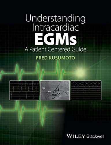 Understanding Intracardiac Egms A Patient Centered Guide 1st Edition Fred Kusumoto