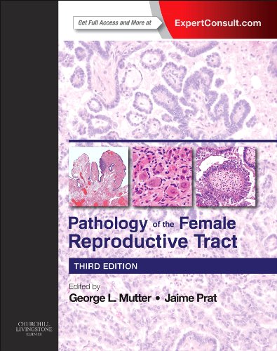 Pathology Of The Female Reproductive Tract 3rd Edition George L Mutter