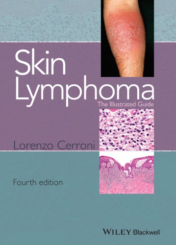 Skin Lymphoma The Illustrated Guide 4th Edition Lorenzo Cerroni
