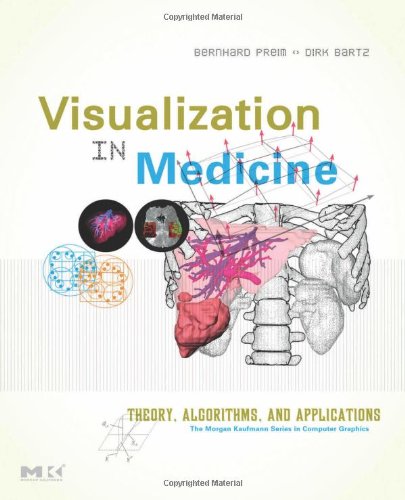 Visualization In Medicine Theory Algorithms And Applications 1st Edition Bernhard Preim