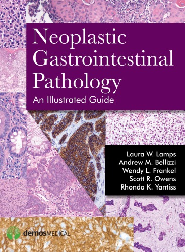 Neoplastic Gastrointestinal Pathology 1st Edition Laura Lamps