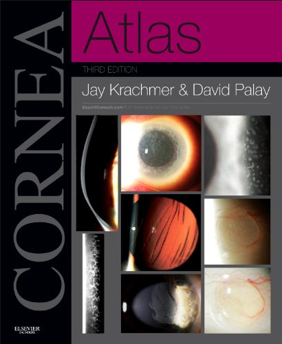 Cornea Atlas 3rd Edition Jay H Krachmer David A Palay