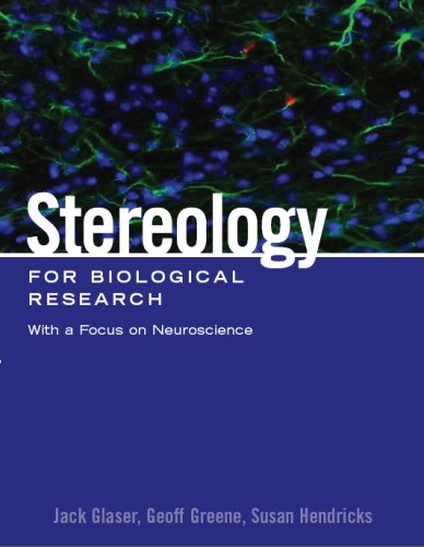 Stereology For Biological Research With A Focus On Neuroscience 2nd Jack Glaser