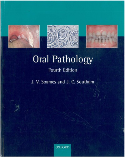 Oral Pathology J V Soames And J C Southam