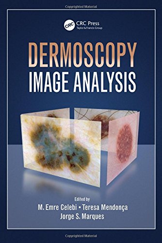 Dermoscopy Image Analysis 1st Edition Celebi M Emre Marques