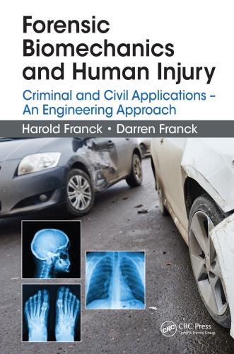 Forensic Biomechanics And Human Injury Criminal And Civil Applications An Engineering Approach Franck