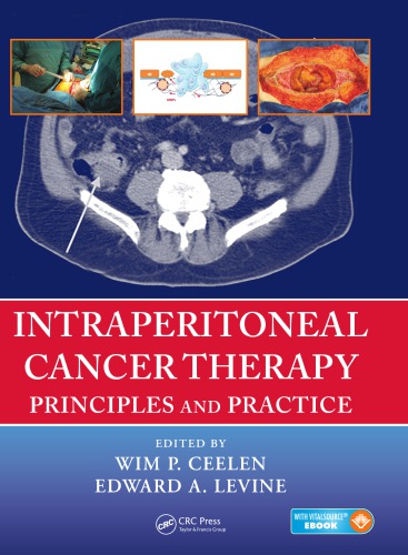 Intraperitoneal Cancer Therapy Principles And Practice Ceelen