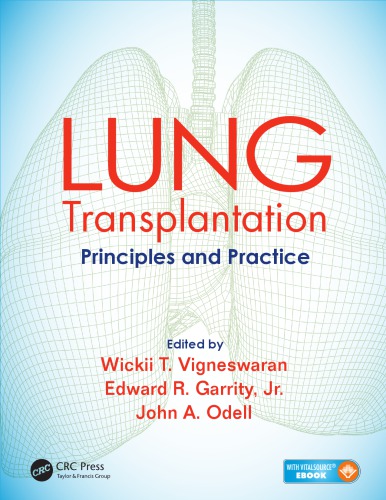 Lung Transplantation Principles And Practice Garrity Edward R Odell