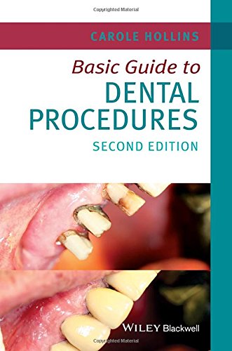 Basic Guide To Dental Procedures 2nd Edition Carole Hollins