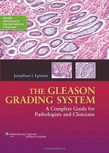 The Gleason Grading System A Complete Guide For Pathologist And Clinicians 1st Edition Jonathan I Epstein