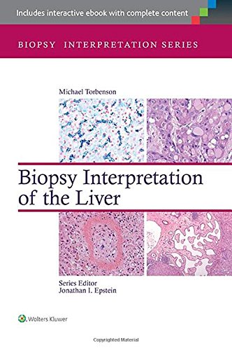 Biopsy Interpretation Of The Liver 3rd Edition Michael Torbenson
