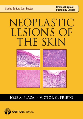 Neoplastic Lesions Of The Skin 1st Edition Jose Plaza Victor Prieto
