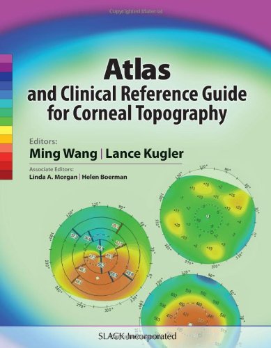 Atlas And Clinical Reference Guide For Corneal Topography 1st Edition Ming Wang