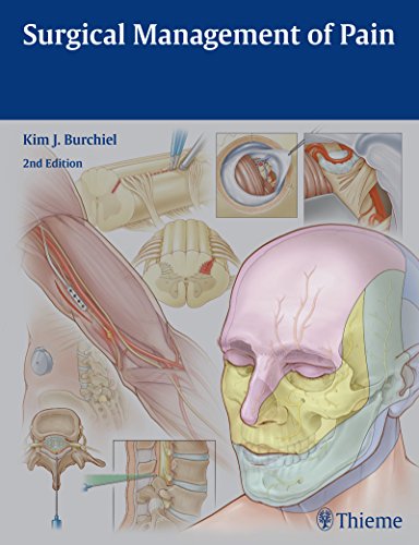Surgical Management Of Pain 2nd Edition Kim J Burchiel