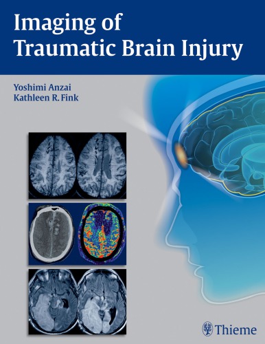 Imaging Of Traumatic Brain Injury 1st Edition Yoshimi Anzai Kathleen R Fink