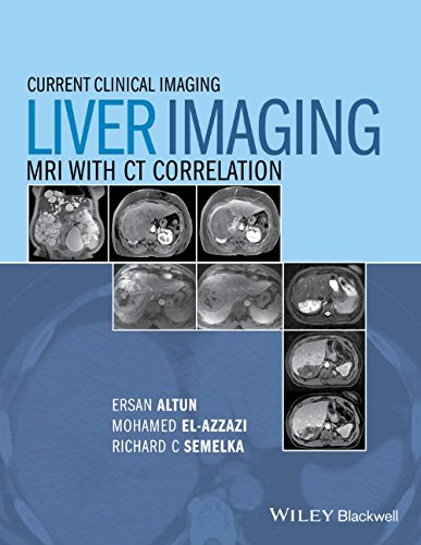Liver Imaging Mri With Ct Correlation 1st Edition Ersan Altun