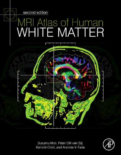 Mri Atlas Of Human White Matter 2nd Edition Kenichi Oishi Andreia V Faria