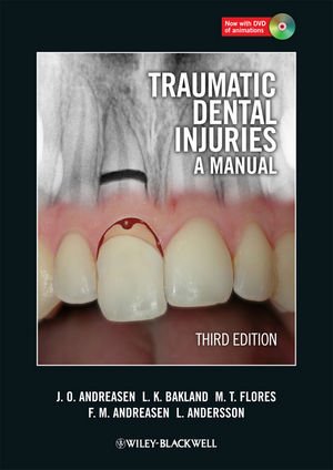 Traumatic Dental Injuries A Manual 3rd Edition Jens O Andreasen