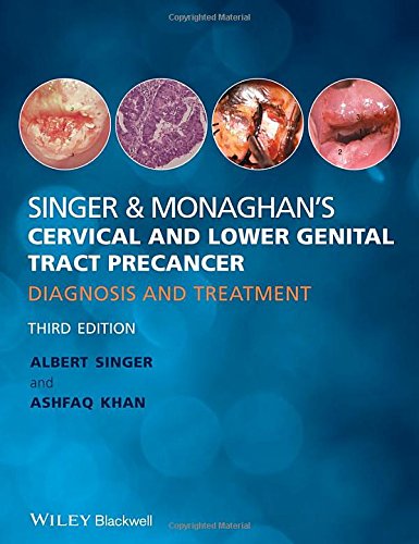 Singer Monaghans Cervical And Lower Genital Tract Precancer Diagnosis And Treatment Third Edition Khan