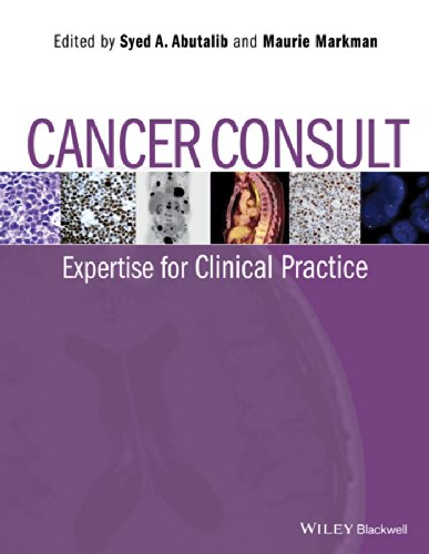Cancer Consult Expertise For Clinical Practice 1st Edition Abutalib