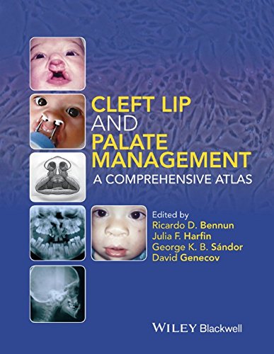 Cleft Lip And Palate Management A Comprehensive Atlas 1st Edition Bennun
