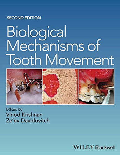Biological Mechanisms Of Tooth Movement Second Edition Davidovitch