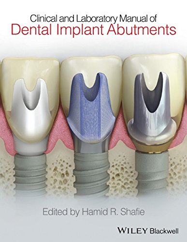 Clinical And Laboratory Manual Of Dental Implant Abutments 1st Edition Hamid R Shafie