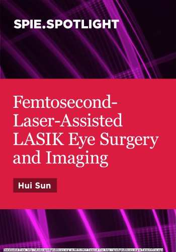 Femtosecondlaserassisted Lasik Eye Surgery And Imaging Sun