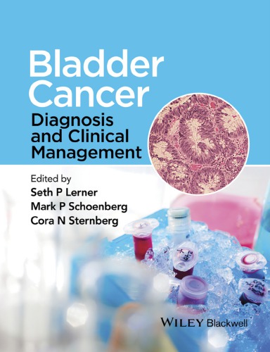 Bladder Cancer Diagnosis And Clinical Management Lerner Seth P Schoenberg