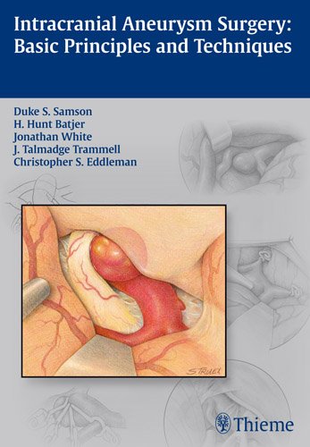 Intracranial Aneurysm Surgery Basic Principles And Techniques 1st Edition Duke Samson