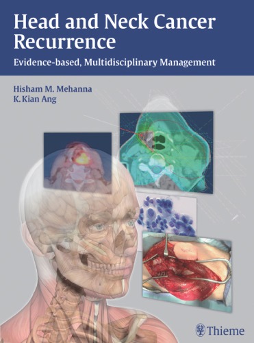 Head And Neck Cancer Recurrence Evidencebased Multidisciplinary Management 1st Edition Hisham M Mehanna